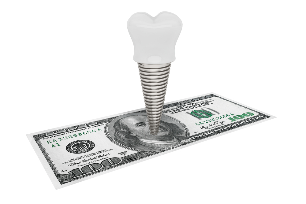 dental-implants-a-solution-that-pays-for-itself